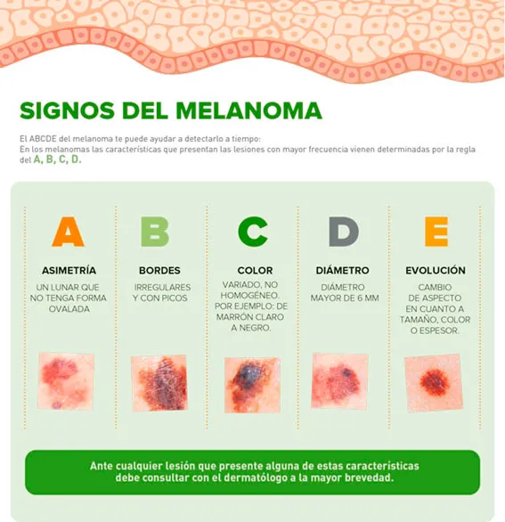Sociedad Española de Oncología Médica